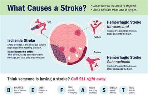 family strokes what happens|Top 10 Causes of Strokes .